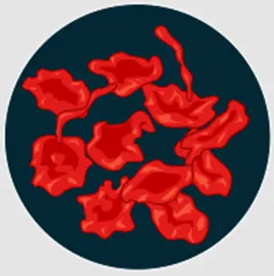 Hypertonic solution for cells